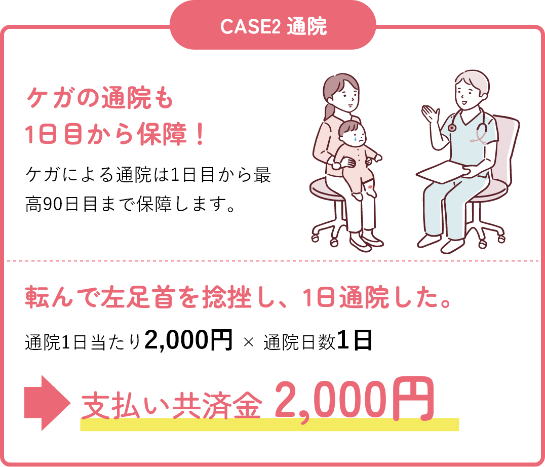 転んで左足首を捻挫し、1日通院した。通院1日当たり2,000円 × 通院日数1日 支払い共済金 2,000円