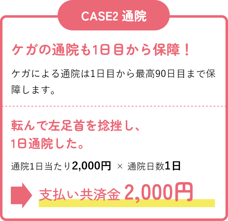 転んで左足首を捻挫し、1日通院した。通院1日当たり2,000円 × 通院日数1日 支払い共済金 2,000円